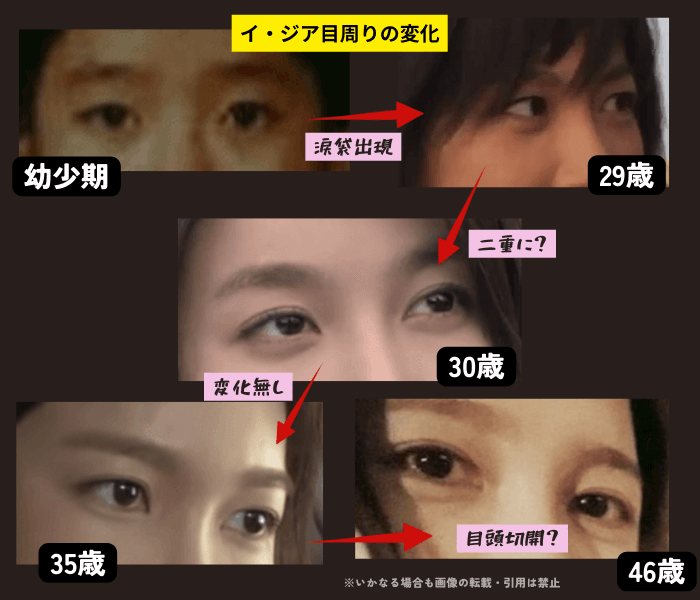 韓国女優イ・ジアの目周りの変化について時系列検証画像
以下5枚の画像

幼少期（左上画像）
29歳（右上画像）
30歳（中央画像）
35歳（左下画像）
46歳（右下画像）

29歳で女優デビューしたイ・ジア。
幼少期と29歳デビュー時の画像は目は、一重もしくは奥二重。
しかし翌年30歳になると目がぱっちり二重に変化している。
また、46歳画像の目頭を確認すると、かなり広がって中まで見えており、目頭切開の可能性が考えられる。